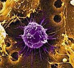 Cellule staminali vegetarianesimo malattie dieta