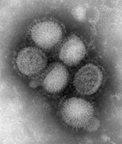 Virus influenza H1N1 vaccino influenza H1N1