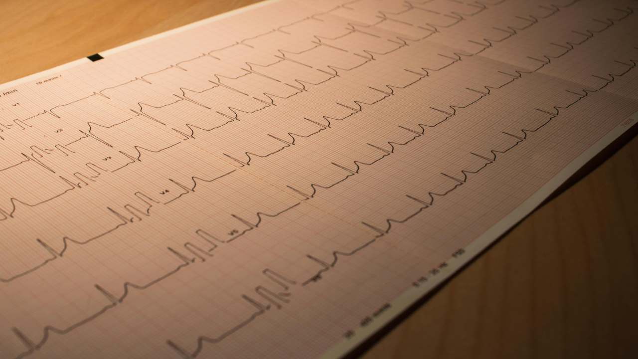 Infarto (pexels.com) - terranauta.it